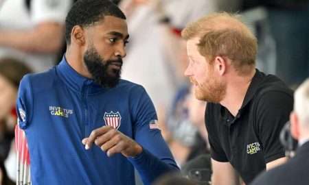Is Prince Harry balding?